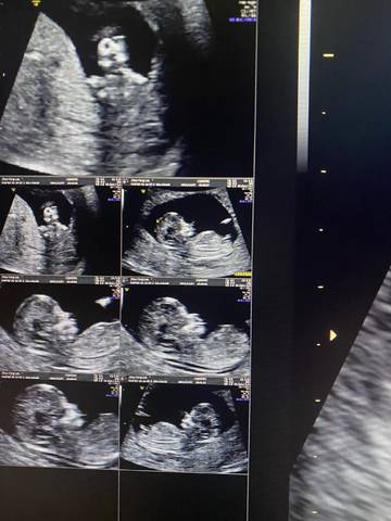 journal_insert_pic_1675836259