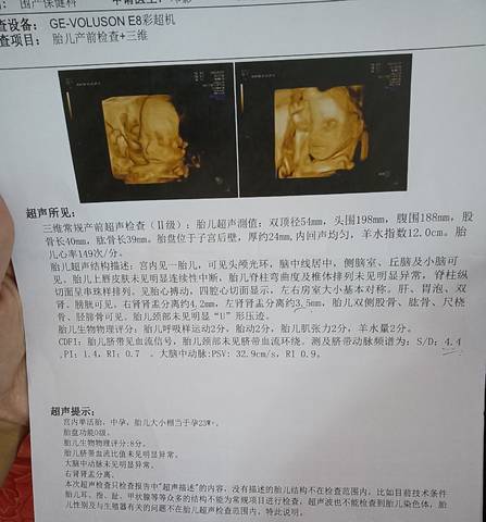 journal_insert_pic_1674492870