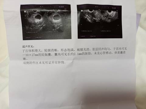 journal_insert_pic_1685465647