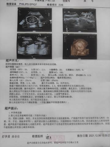 journal_insert_pic_1675223628