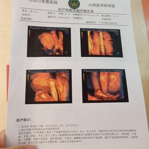 journal_insert_pic_1689342442