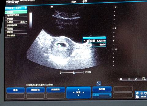 journal_insert_pic_1686145080