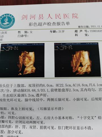 journal_insert_pic_1677556118