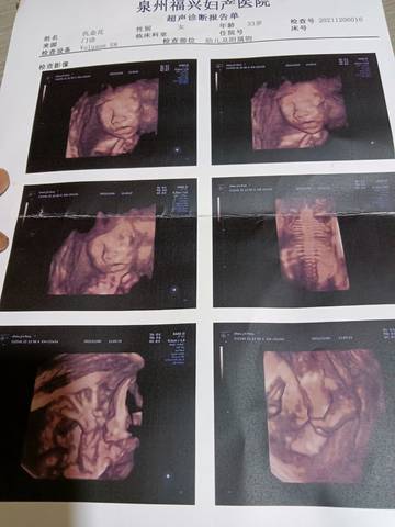 journal_insert_pic_1674792398