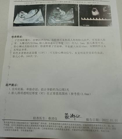 journal_insert_pic_1690112068