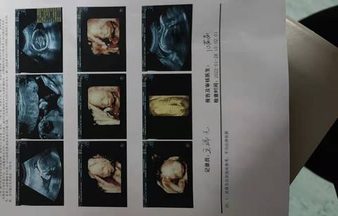 journal_insert_pic_1719880923