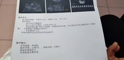 journal_insert_pic_1677348860