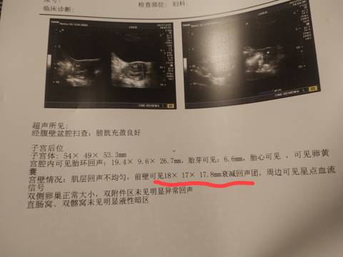 journal_insert_pic_1688138311