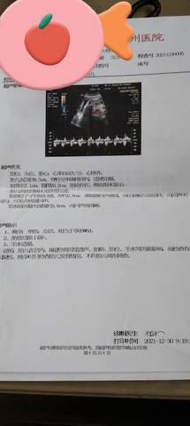 journal_insert_pic_1690108939