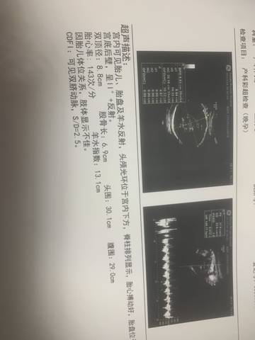 journal_insert_pic_1682697957