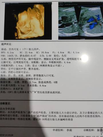 journal_insert_pic_1682712053