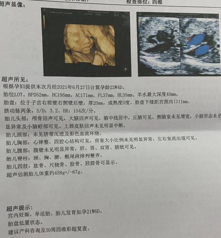 journal_insert_pic_1676642980