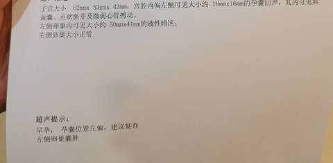 journal_insert_pic_1682106349
