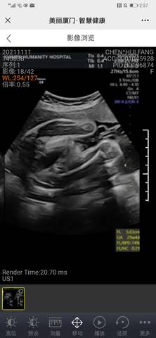 journal_insert_pic_1685302170