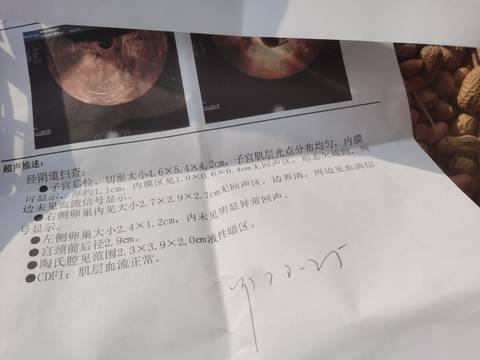 journal_insert_pic_1676673085