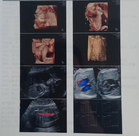 journal_insert_pic_1681553082