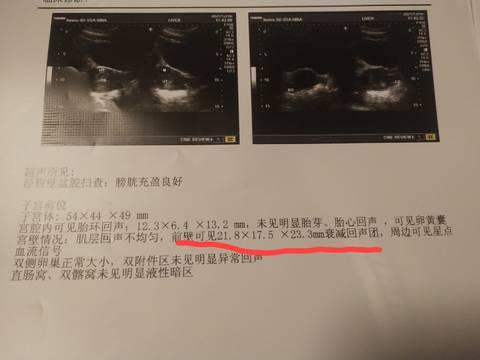 journal_insert_pic_1688138216