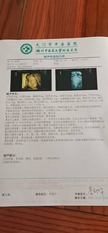 journal_insert_pic_1684559301