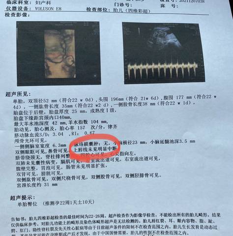 journal_insert_pic_1685543295