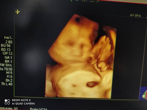 journal_insert_pic_1683086854