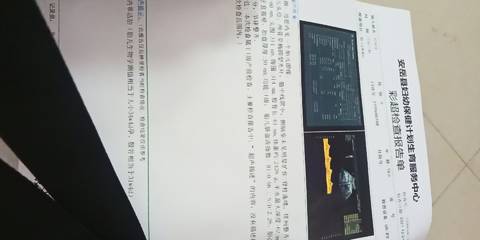 journal_insert_pic_1674039574