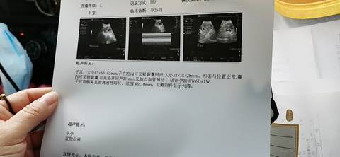 journal_insert_pic_1685252253