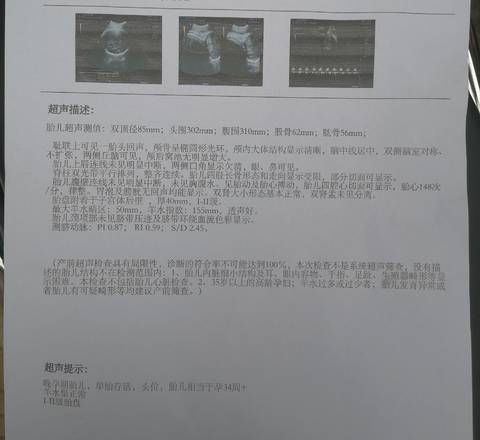 journal_insert_pic_1684148003