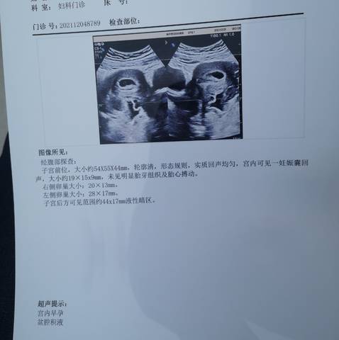 journal_insert_pic_1688809960