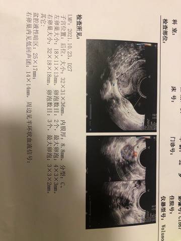 journal_insert_pic_1689078294