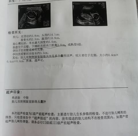 journal_insert_pic_1675521824