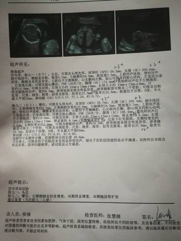 journal_insert_pic_1685531647