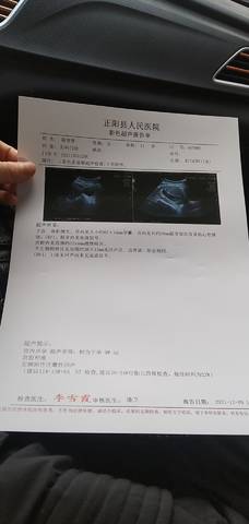 journal_insert_pic_1676821443