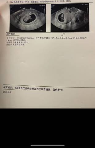 journal_insert_pic_1689182044