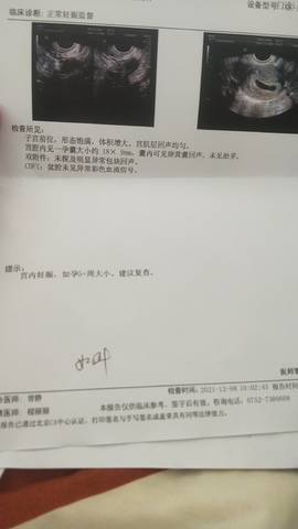 journal_insert_pic_1676057715