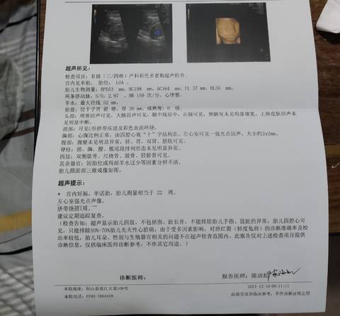 journal_insert_pic_1677539028