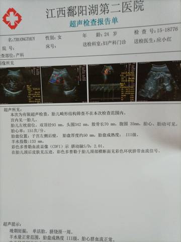 journal_insert_pic_1682638008