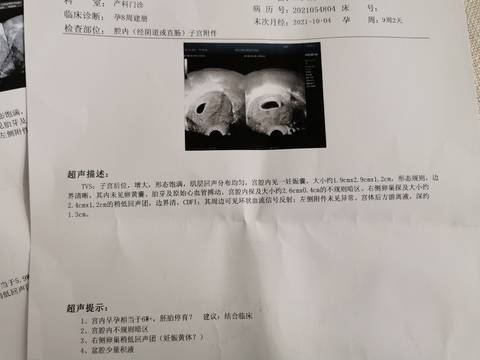 journal_insert_pic_1676140537