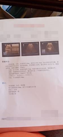 journal_insert_pic_1677293594