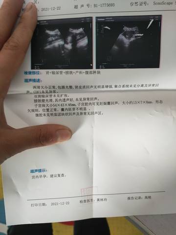 journal_insert_pic_1688357983