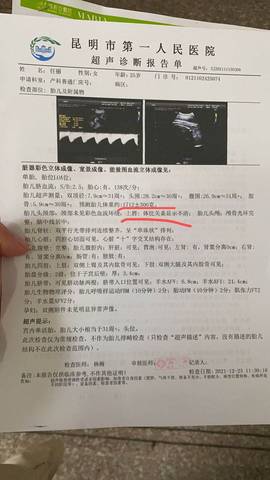 journal_insert_pic_1689481570