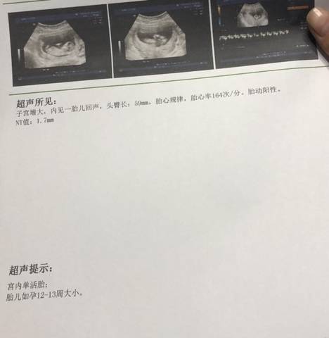 journal_insert_pic_1687845677
