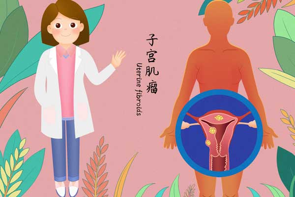 子宫肌瘤医疗插画.jpg