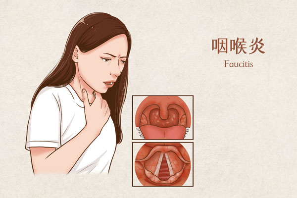摄图网_401799105_banner_咽喉炎医疗插画（企业商用）.jpg