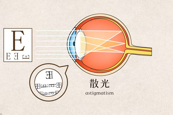 摄图网_401789652_banner_散光医疗插画（企业商用）.jpg