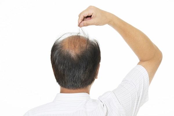 摄图网_501661374_头发稀少的中年大叔（企业商用）.jpg