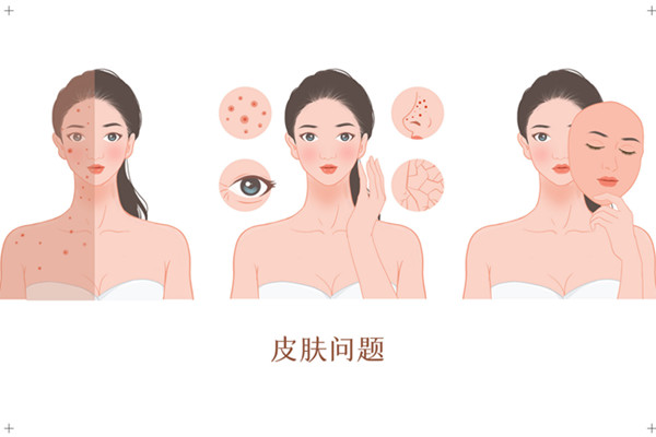 身上痒6002.jpg