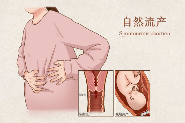 摄图网_401862933_banner_自然流产医疗插画（企业商用）.jpg