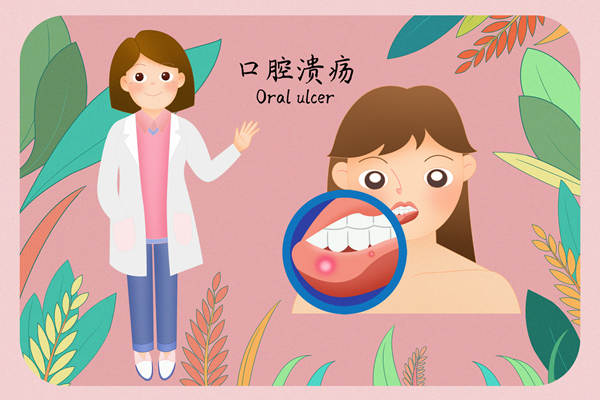 口腔溃疡(1).jpg